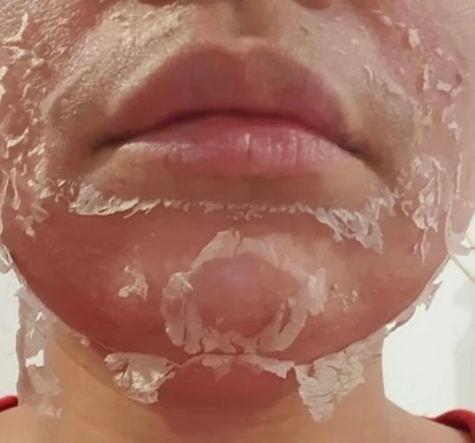 Peeling aux algues 5 g