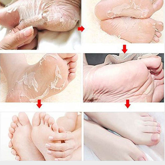 Peeling pour les pieds